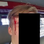 Burschenschaftler geschlagen